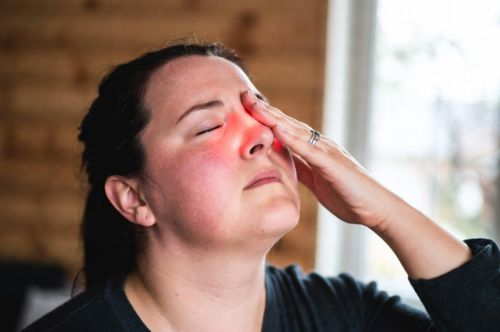 Полипы носа