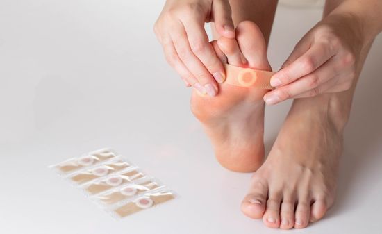 Подошвенная бородавка