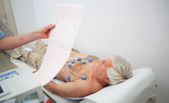 Электрокардиография