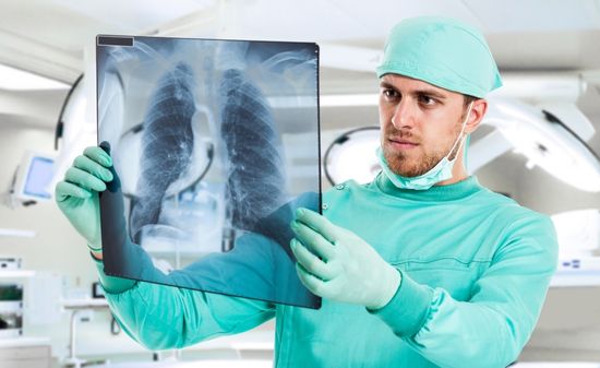 Рентгенография