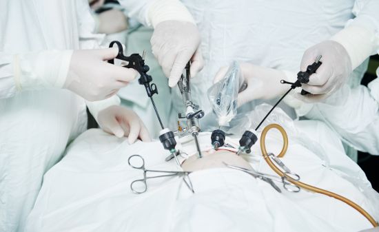 Фундопликация по Ниссену