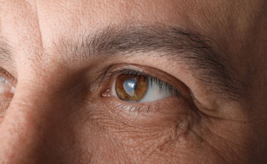 Вторичная катаракта: причины, симптомы, лечение